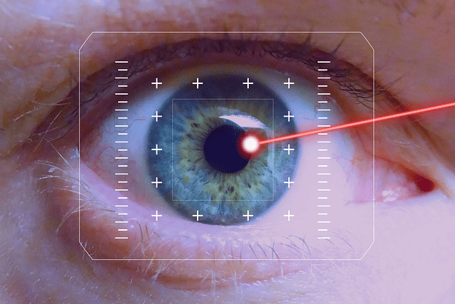 chirurgie réfractive des yeux