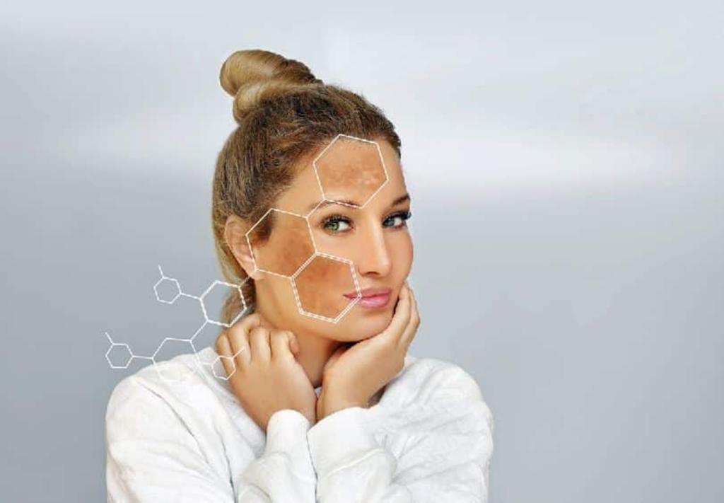 femme-avec-des-taches-sur-le-visage-masque-de-grossesse
