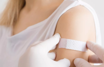 ALERGIE AU PANSEMENT : Les signes d’alerte et ce qu’il faut faire immédiatement